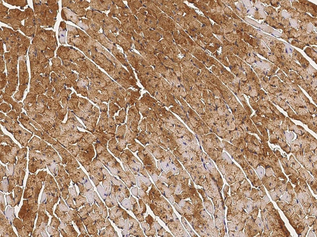 HSPB7 Antibody in Immunohistochemistry (Paraffin) (IHC (P))