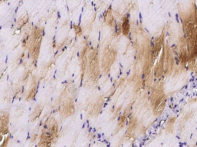 HSPB7 Antibody in Immunohistochemistry (Paraffin) (IHC (P))