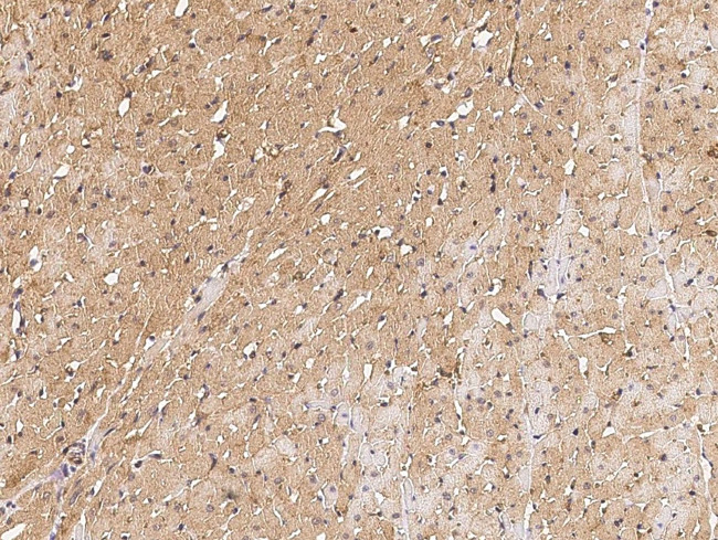 HSPB7 Antibody in Immunohistochemistry (Paraffin) (IHC (P))