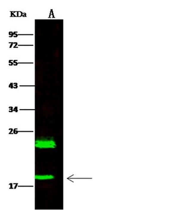 HSPB7 Antibody in Western Blot (WB)