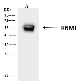 RNMT Antibody in Immunoprecipitation (IP)