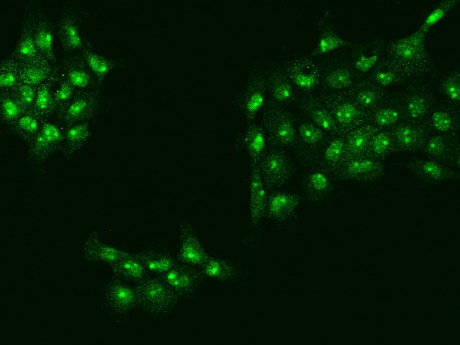 UTP18 Antibody in Immunocytochemistry (ICC/IF)