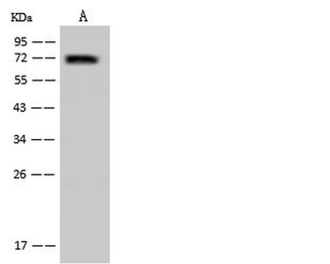 UTP18 Antibody in Western Blot (WB)