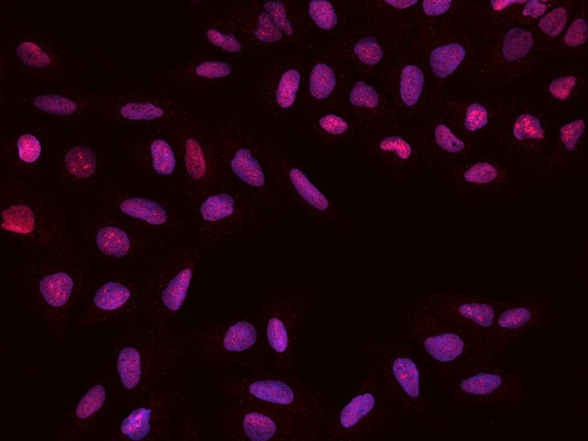 PAPSS1 Antibody in Immunocytochemistry (ICC/IF)