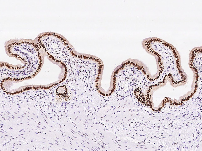 PAPSS1 Antibody in Immunohistochemistry (Paraffin) (IHC (P))