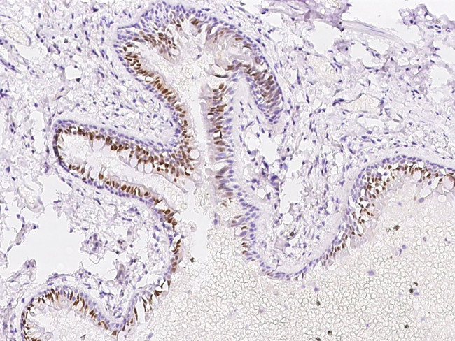 PAPSS1 Antibody in Immunohistochemistry (Paraffin) (IHC (P))