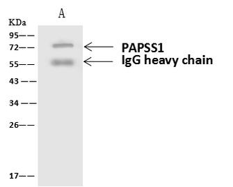 PAPSS1 Antibody in Immunoprecipitation (IP)