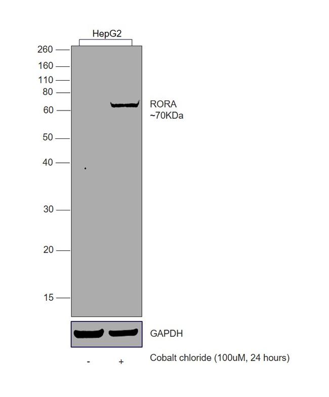 RORA Antibody - middle region (ARP34767_P050)