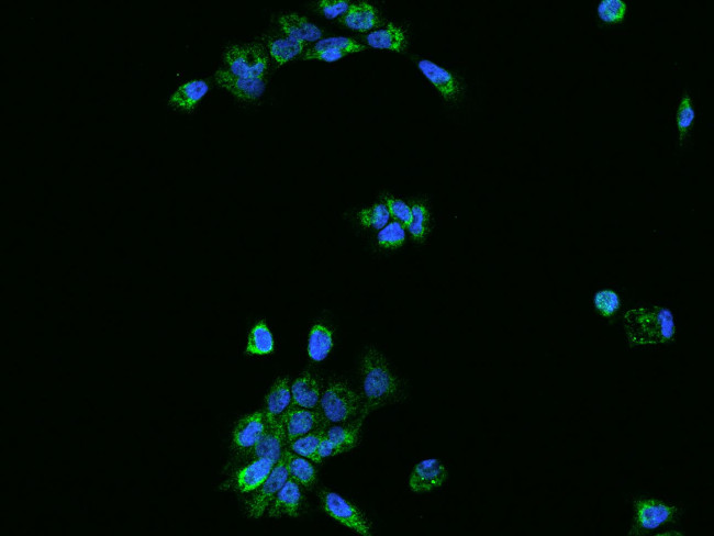 OXCT1 Antibody in Immunocytochemistry (ICC/IF)