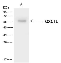 OXCT1 Antibody in Immunoprecipitation (IP)