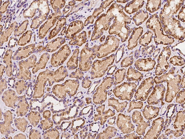 SBCAD Antibody in Immunohistochemistry (Paraffin) (IHC (P))