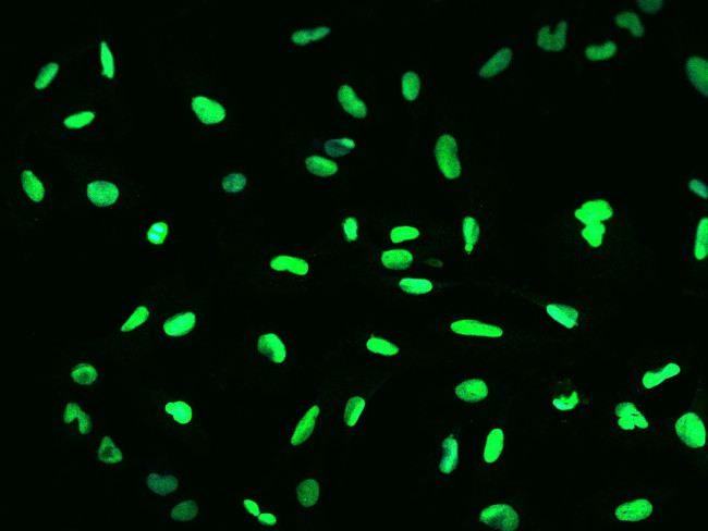 GTF2F2 Antibody in Immunocytochemistry (ICC/IF)