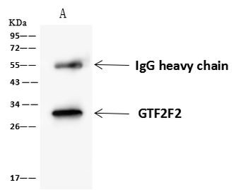 GTF2F2 Antibody in Immunoprecipitation (IP)