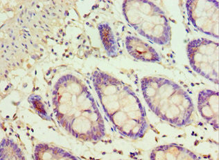 ADSS Antibody in Immunohistochemistry (Paraffin) (IHC (P))