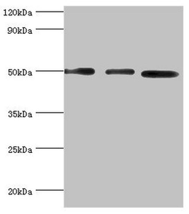 ADSS Antibody in Western Blot (WB)