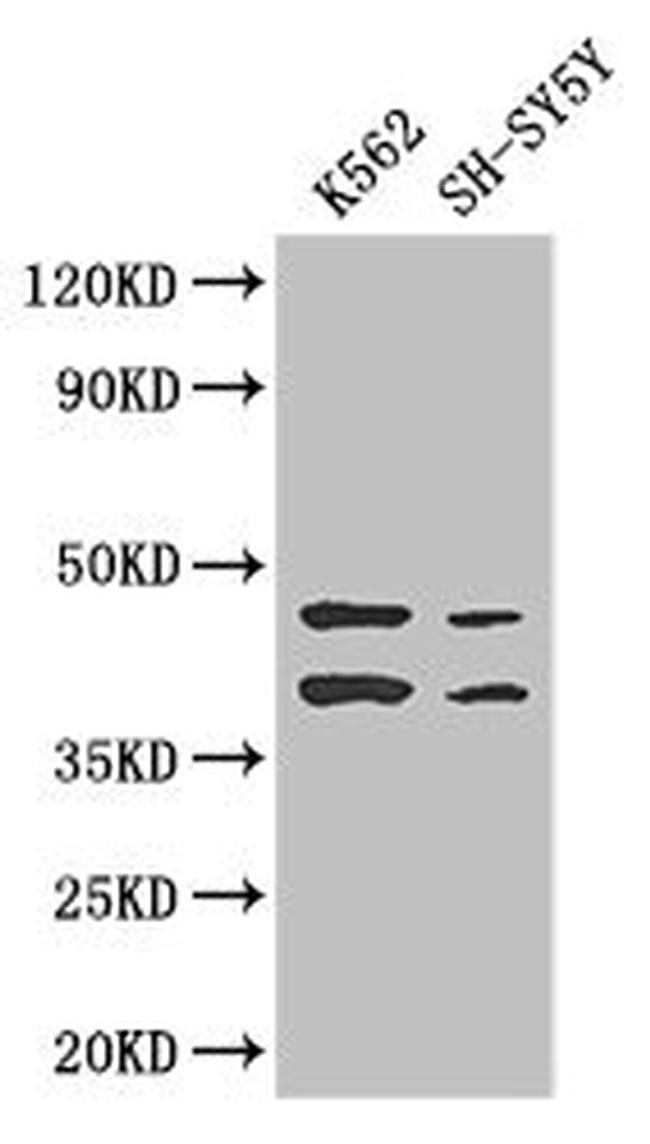 AIM2 Antibody in Western Blot (WB)