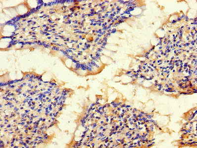 BLOC1S1 Antibody in Immunohistochemistry (Paraffin) (IHC (P))