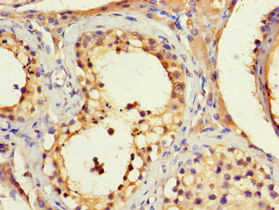 BLOC1S1 Antibody in Immunohistochemistry (Paraffin) (IHC (P))