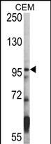 HDAC7 Antibody in Western Blot (WB)