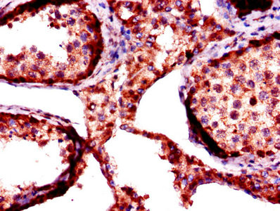 FKBP6 Antibody in Immunohistochemistry (Paraffin) (IHC (P))