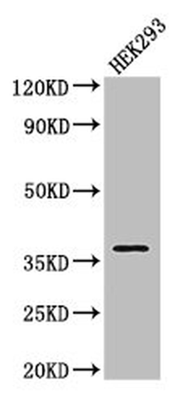 FKBP6 Antibody in Western Blot (WB)