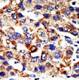 HDAC8 Antibody in Immunohistochemistry (Paraffin) (IHC (P))