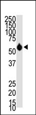 HDAC8 Antibody in Western Blot (WB)