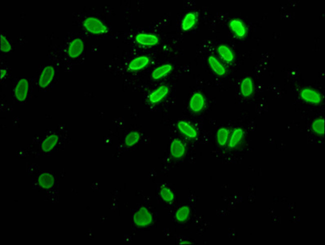 H2A.ZK7ac Antibody in Immunocytochemistry (ICC/IF)