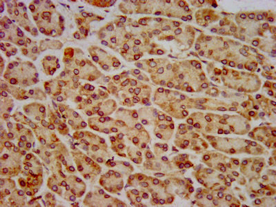 HIP1R Antibody in Immunohistochemistry (Paraffin) (IHC (P))