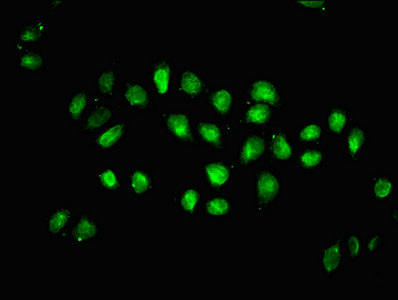 2-hydroxyisobutyryl-Histone H1.2 (Lys26) Antibody in Immunocytochemistry (ICC/IF)