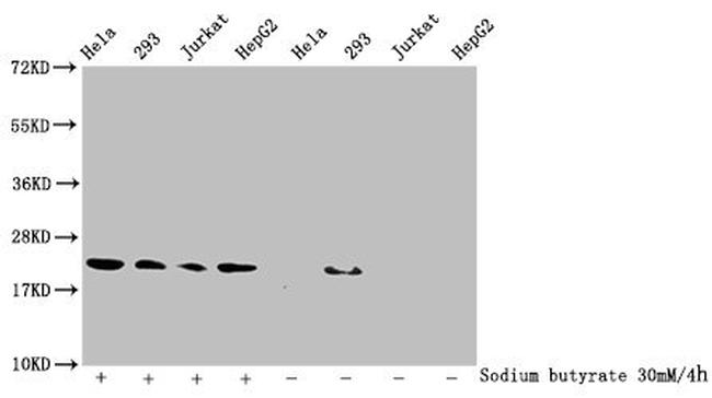 2-hydroxyisobutyryl-Histone H1.2 (Lys26) Antibody in Western Blot (WB)