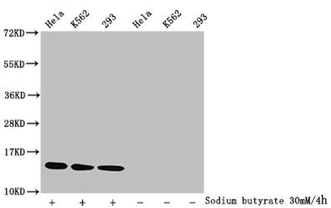 H2BK15ac Antibody in Western Blot (WB)