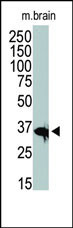 HDAC11 Antibody in Western Blot (WB)