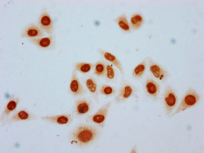 H3K9cr Antibody in Immunocytochemistry (ICC/IF)