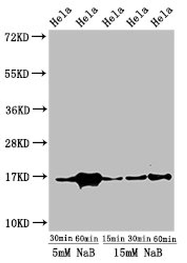 H3K23ac Antibody in Western Blot (WB)