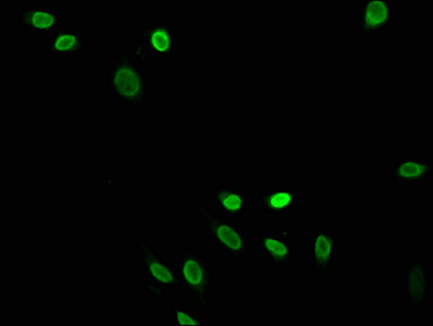 H4K5cr Antibody in Immunocytochemistry (ICC/IF)