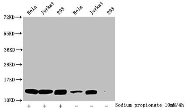 H4K5pr Antibody in Western Blot (WB)