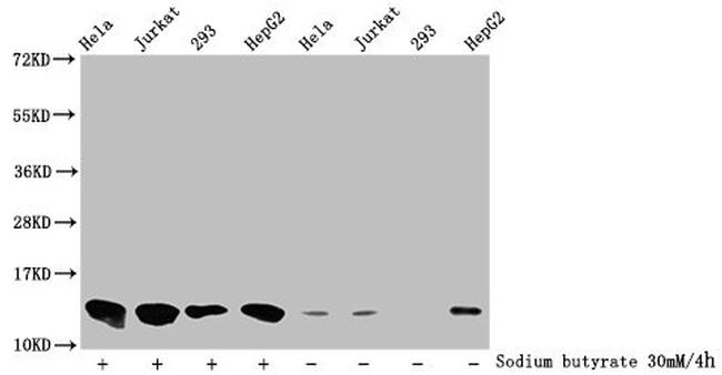 Butyryl-Histone H4 (Lys8) Antibody in Western Blot (WB)