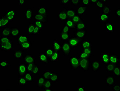 H4K8pr Antibody in Immunocytochemistry (ICC/IF)