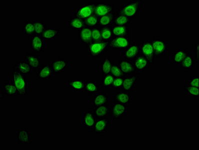 H4K12cr Antibody in Immunocytochemistry (ICC/IF)