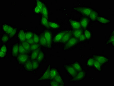 H4K16cr Antibody in Immunocytochemistry (ICC/IF)