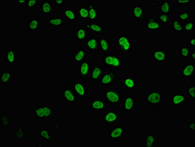 H4K31ac Antibody in Immunocytochemistry (ICC/IF)