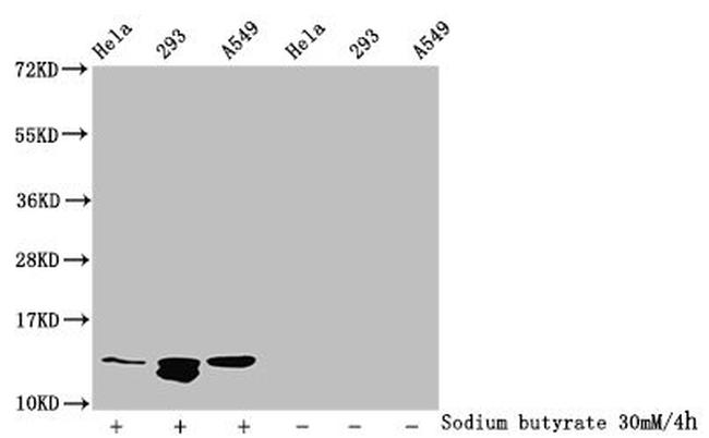 H4K77ac Antibody in Western Blot (WB)