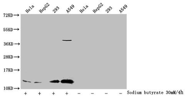 H4K91ac Antibody in Western Blot (WB)