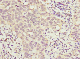 HOXD10 Antibody in Immunohistochemistry (Paraffin) (IHC (P))