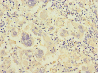 Integrin beta 7 Antibody in Immunohistochemistry (Paraffin) (IHC (P))