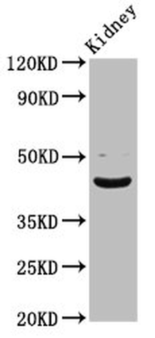 LHX2 Antibody in Western Blot (WB)