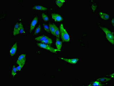 MTHFR Antibody in Immunocytochemistry (ICC/IF)