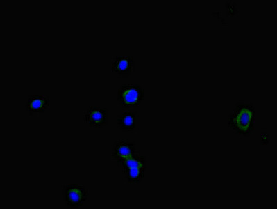 NOXA1 Antibody in Immunocytochemistry (ICC/IF)