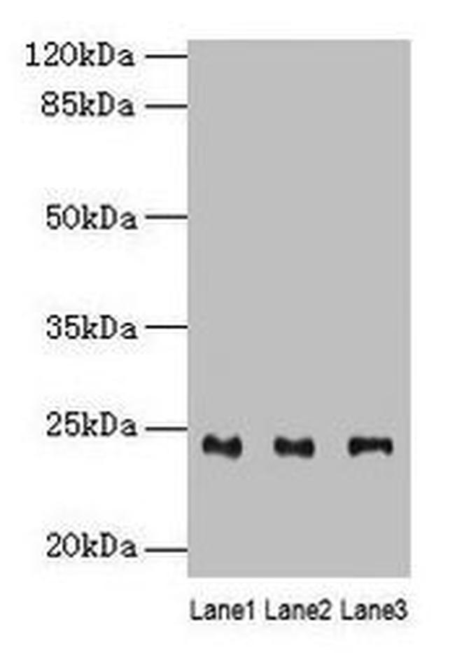 RAB4B Antibody in Western Blot (WB)